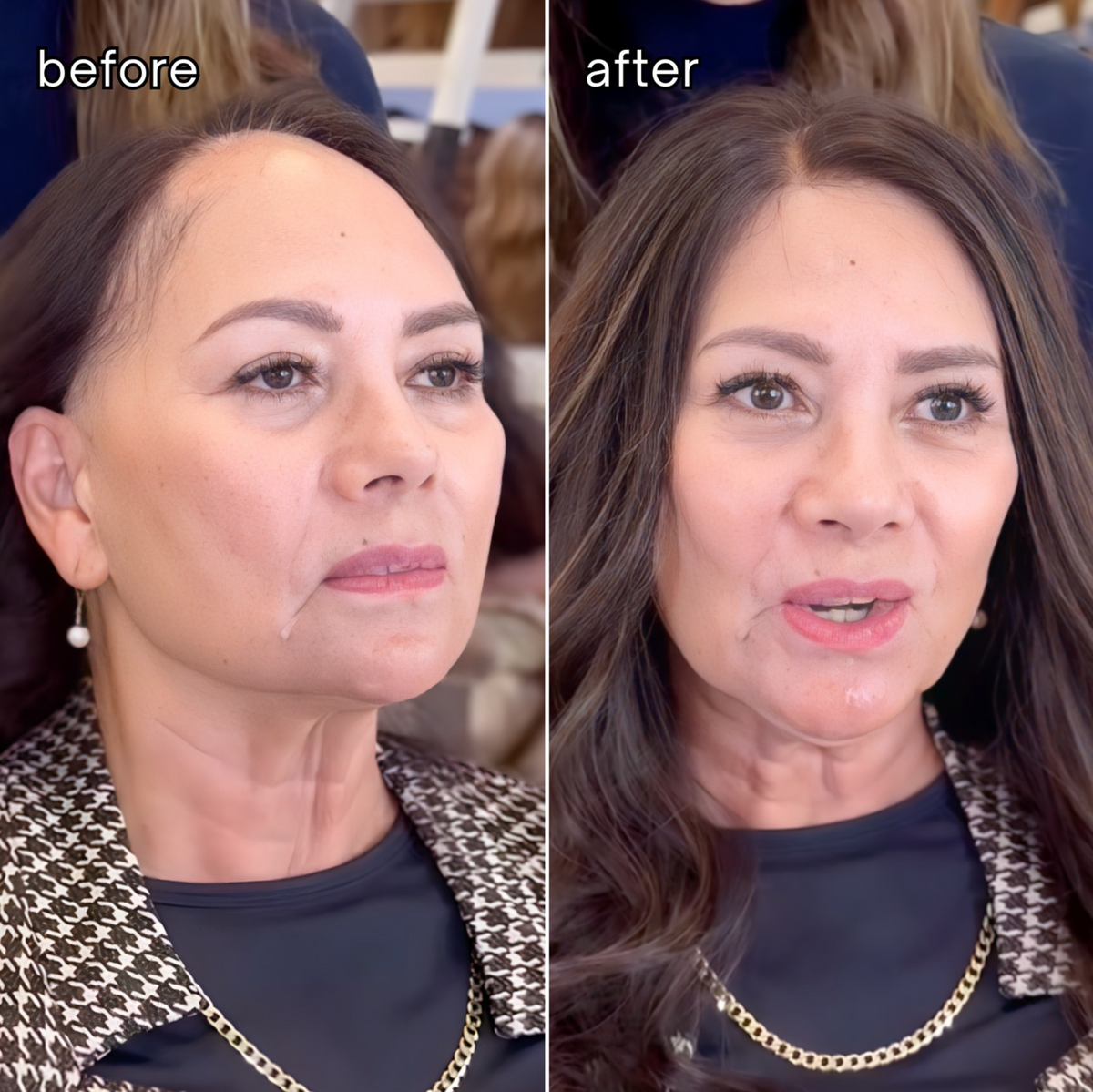 REAL HAIR: Receding Hairline Topper